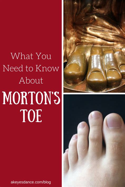 What is the Morton's toe in astrology?