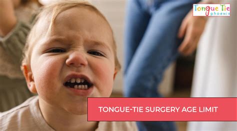 What is the age limit for tongue-tie surgery?