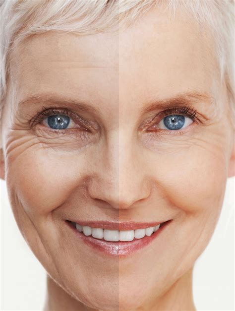 What is the average age to get wrinkles?