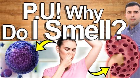 What is the bad smell syndrome?