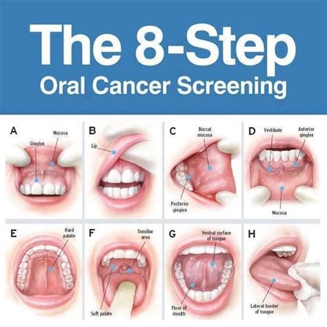 What is the best scan to detect mouth cancer?