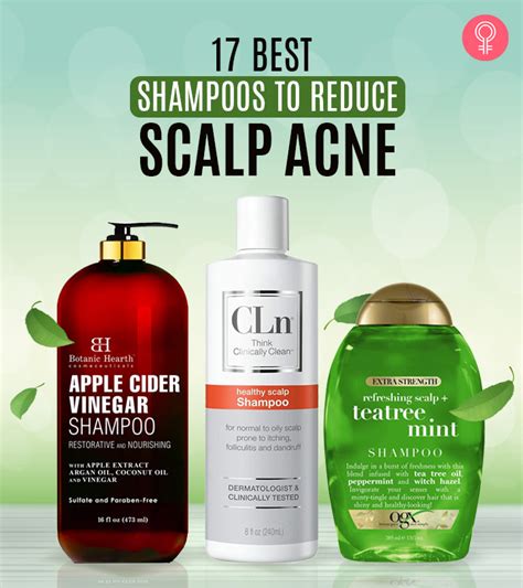 What is the best shampoo for scalp buildup?