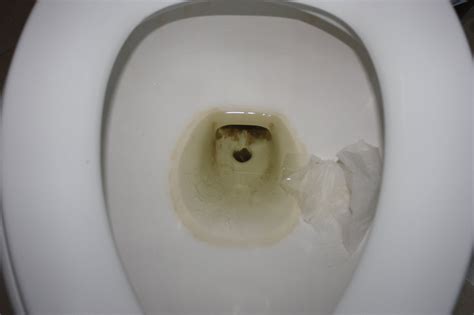 What is the best thing for thick limescale in toilet?