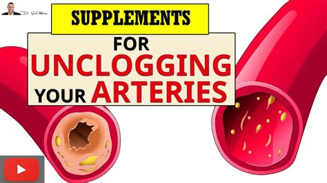 What is the best vitamin for your arteries?