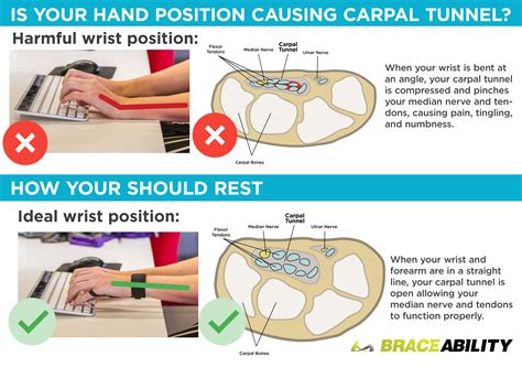What is the best wrist position for carpal tunnel syndrome?