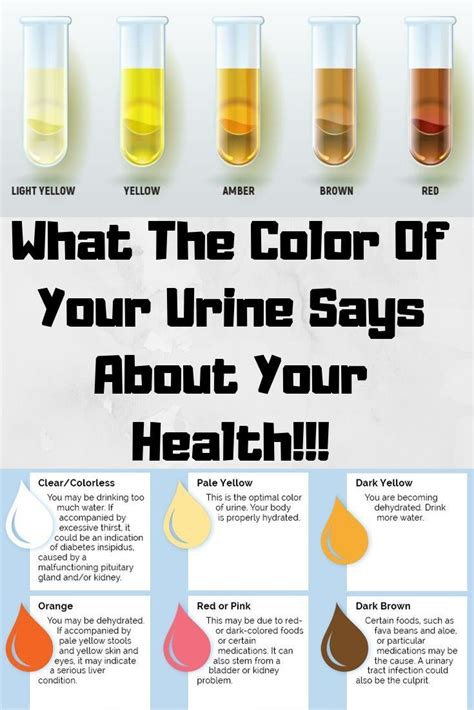 What is the color of healthy pee?