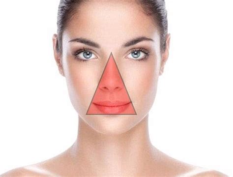 What is the danger triangle pimple?