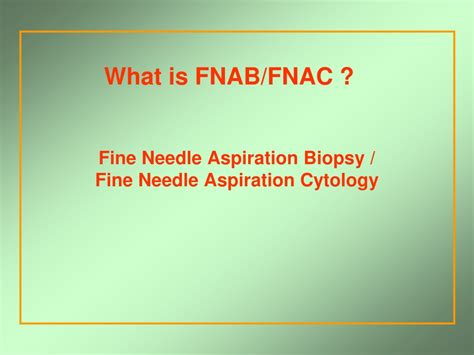 What is the difference between Fnab and FNAC?