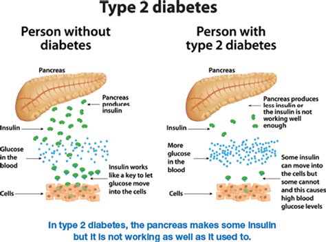 What is the difference between a diabetic pancreas and a healthy pancreas?