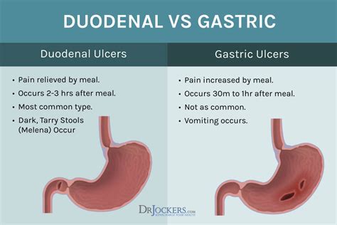 What is the difference between a peptic ulcer and a gastric ulcer?