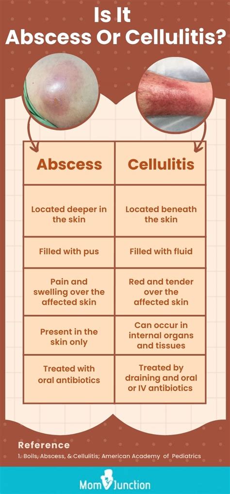 What is the difference between folliculitis and abscess?