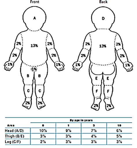 What is the difference between the rule of nines and the Lund and Browder chart?