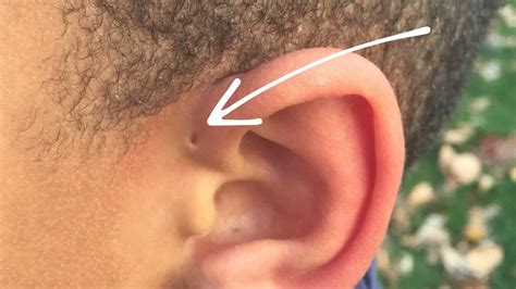 What is the dirt in my earring hole?