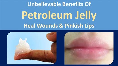 What is the disadvantage of petroleum jelly on lips?