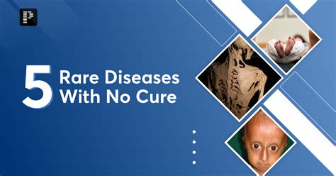 What is the disease that has no cure?