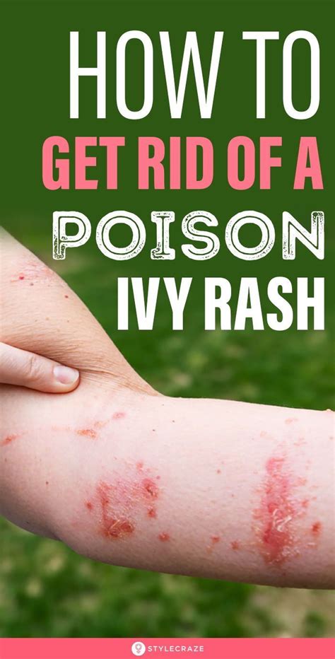 What is the fastest way to get rid of a rash?