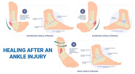 What is the fastest way to heal a foot injury?