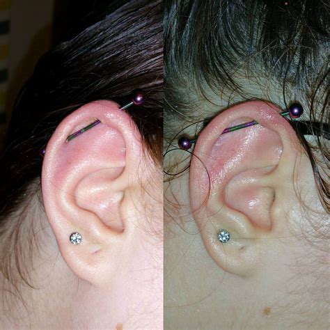 What is the fastest way to heal an infected ear piercing?