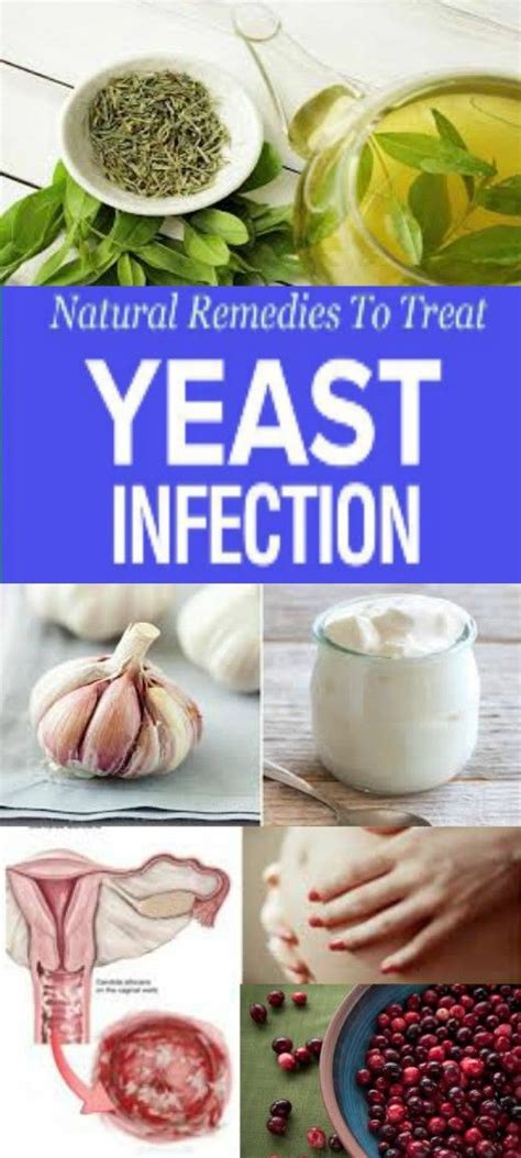 What is the fastest way to soothe a yeast infection?