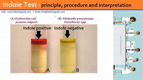 What is the indole test for E. coli?