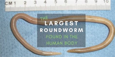 What is the largest parasite found in humans?