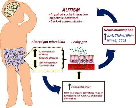 What is the leaky gut theory of autism?