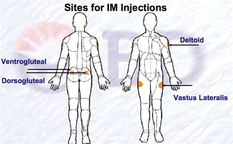 What is the least painful place for an IM shot?