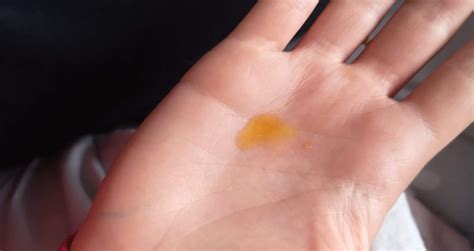 What is the liquid in orange skin?