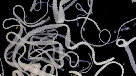 What is the longest tapeworm ever?