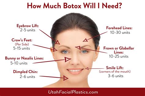 What is the maximum amount of Botox in 3 months?