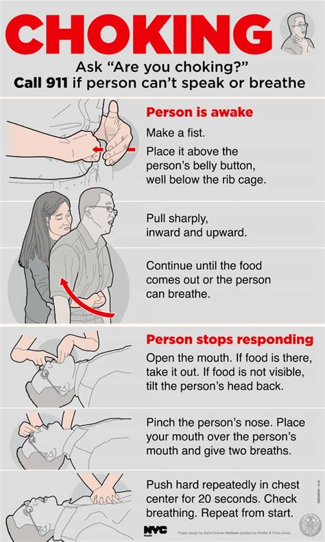 What is the meaning of Heimlich maneuver?