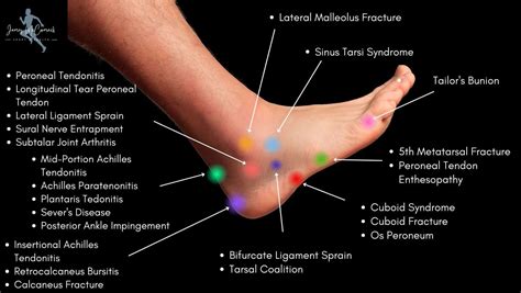 What is the meaning of left foot pain?