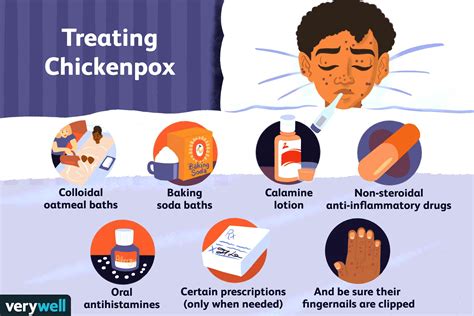 What is the medication for chickenpox in adults?