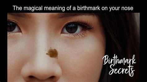 What is the message of the birthmark?