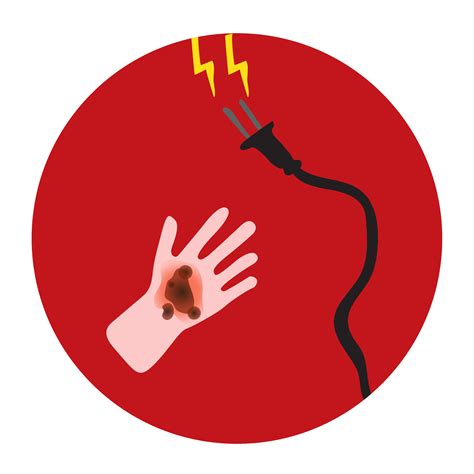 What is the most common electrical burn?