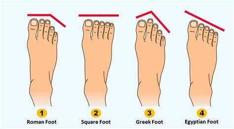 What is the most common foot shape?