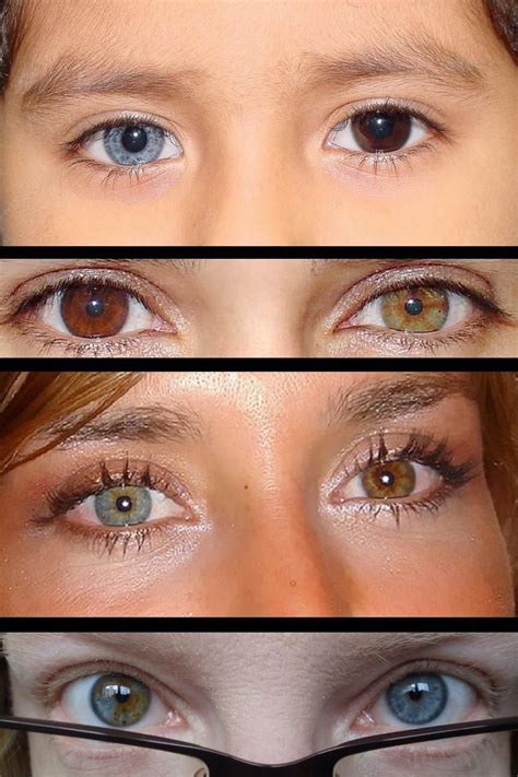 What is the most rare eye color?