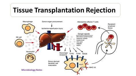 What is the most rejected organ transplant?