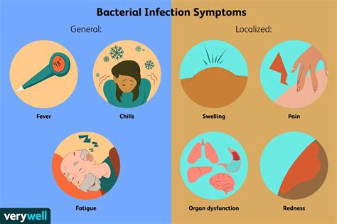 What is the most serious bacterial infection?