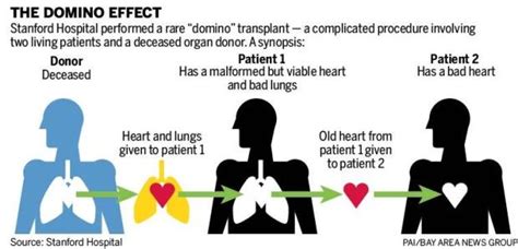 What is the most uncommon transplant?