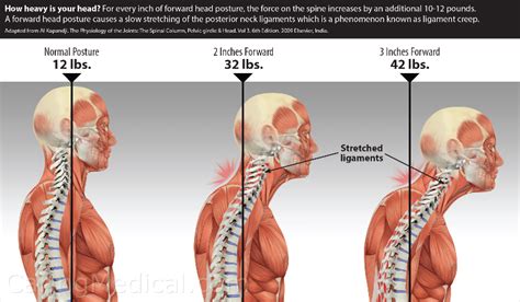 What is the natural shape of neck?