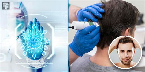 What is the new technology for hair treatment?