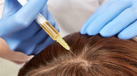 What is the new treatment for hair loss?