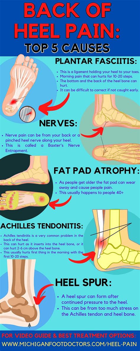 What is the number one cause of heel pain?