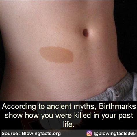 What is the old myth about birthmarks?