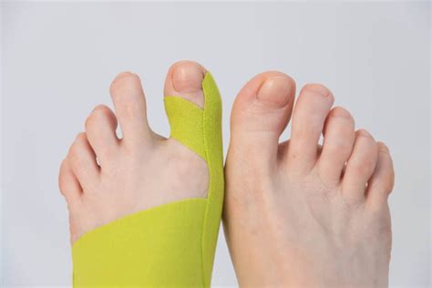 What is the purpose of taping feet?