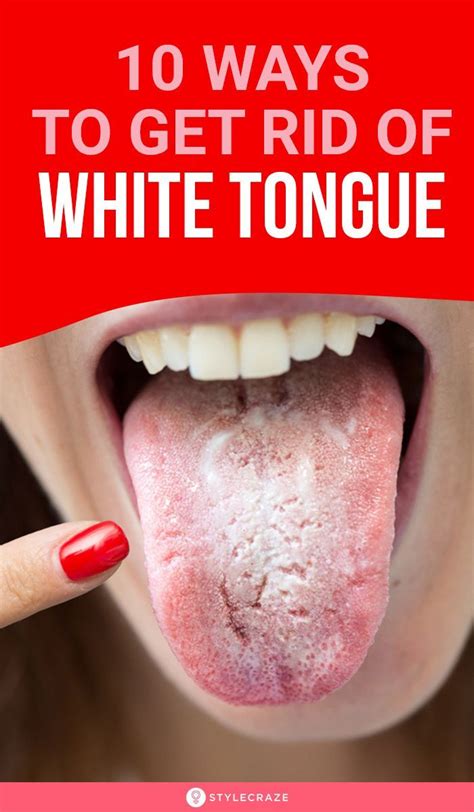 What is the quickest way to get rid of a bump on your tongue?