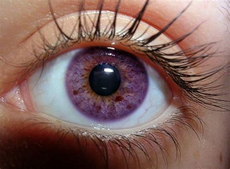 What is the rarest eye color for a human?