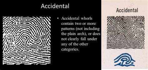 What is the rarest fingerprint?
