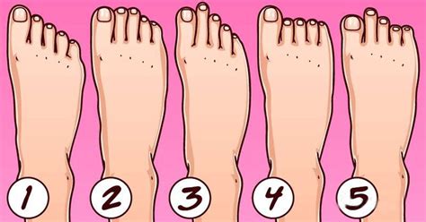 What is the rarest foot shape?